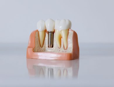 Detailed dental implant model showcasing teeth structure for educational purposes.